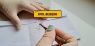 Dúvidas sobre exame toxicológico Dúvidas sobre exame toxicológico